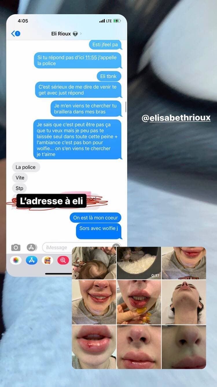 Capture d'écran Instagram @milaydie