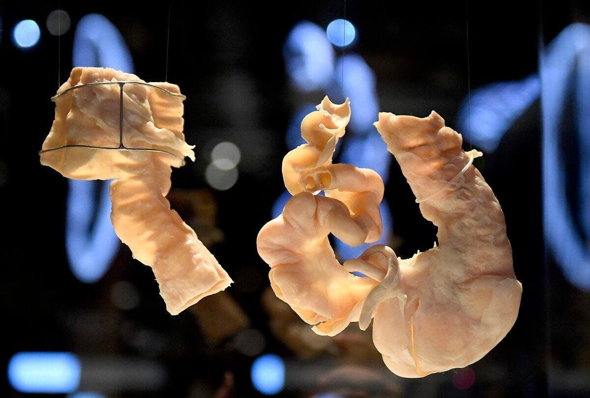 Stevens LeBlanc/JOURNAL DE QUEBEC