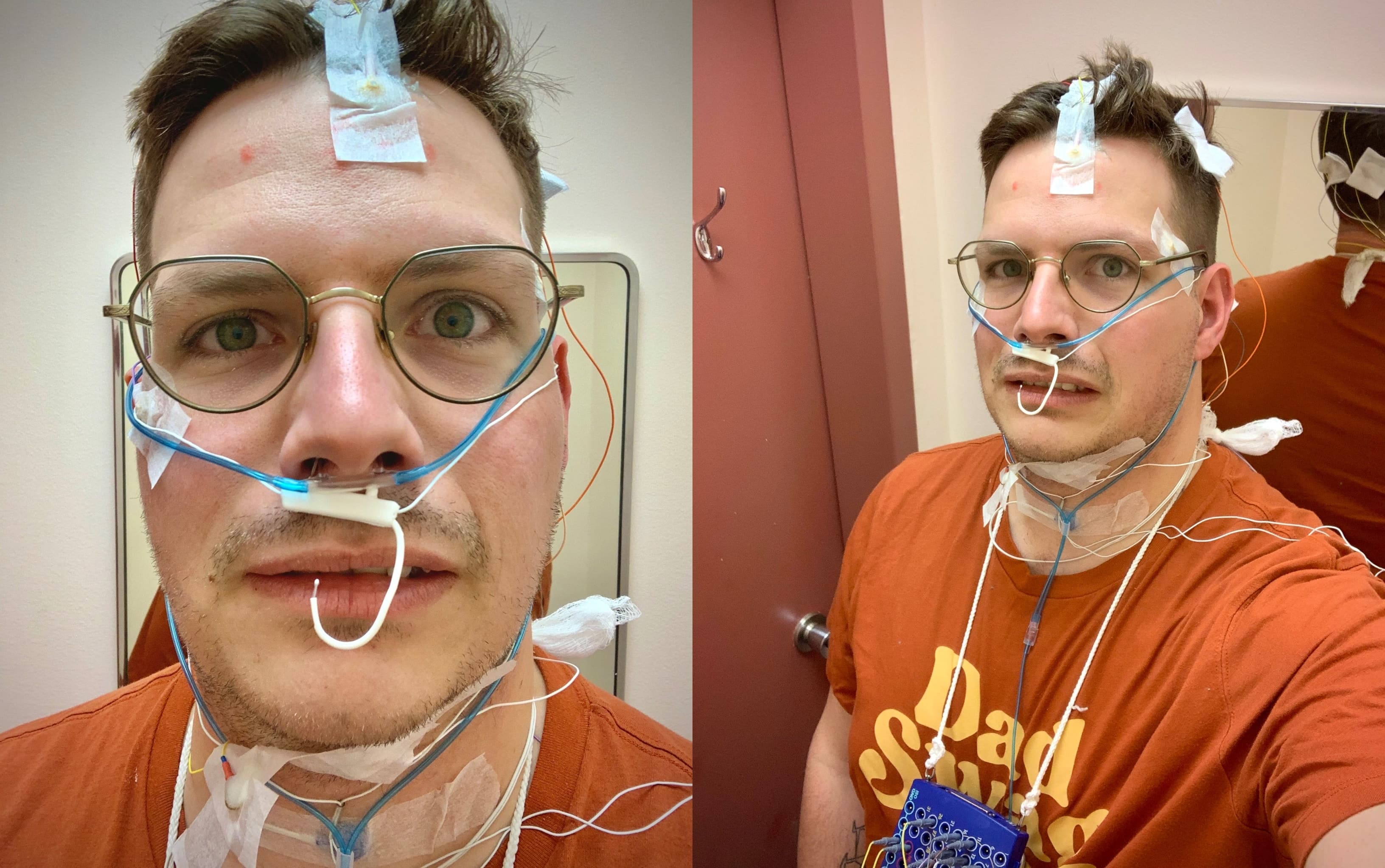 Un aperçu de ce que j'avais l'air, une fois les électrodes installées ici et là sur le haut du corps.