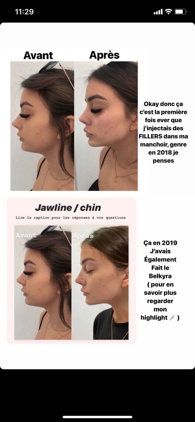 Instagram / Milaydie Bujold