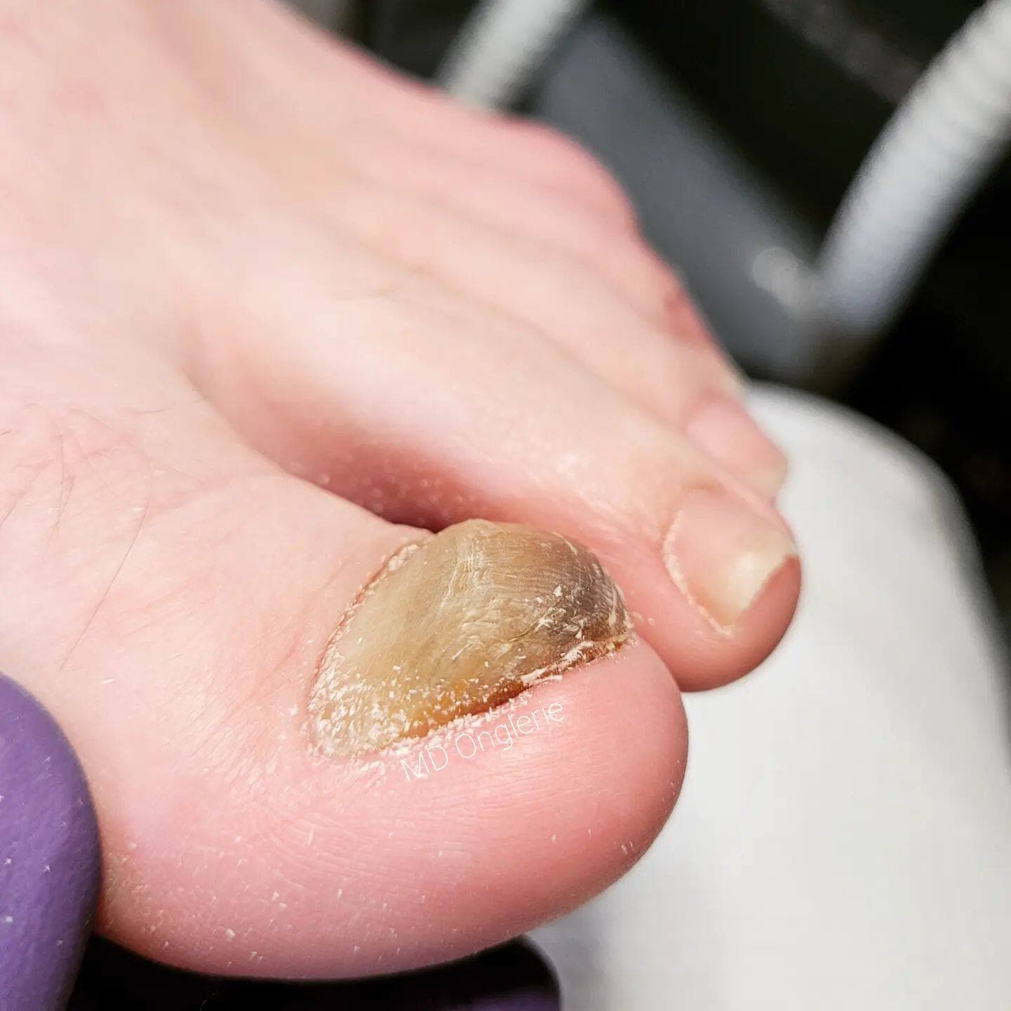 Facebook MD Onglerie