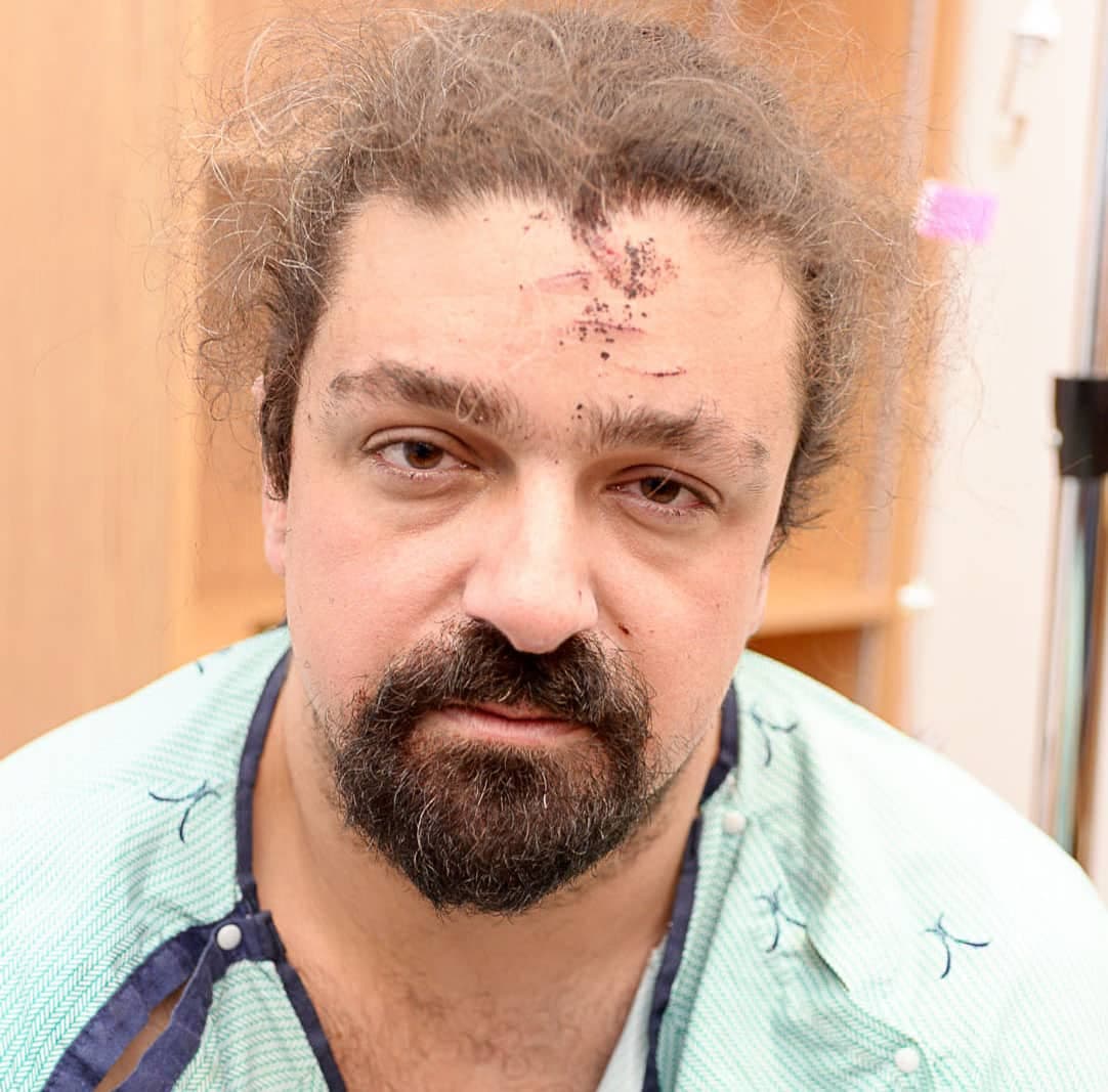 Lors de son admission à l’hôpital, Benoit Cardinal avait une blessure au front prenant la forme de trois griffures.